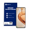 TCL 20S Hydrogel Screen Protector