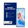 ZTE Nubia Z40S Pro Hydrogel Screen Protector