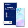 ZTE Axon 5G Hydrogel Screen Protector